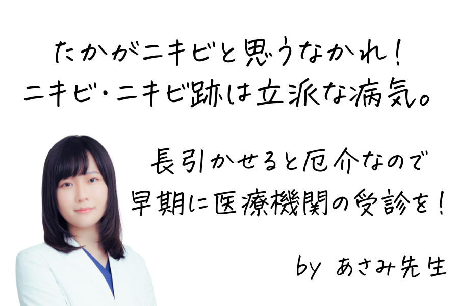 ニキビ・ニキビ跡ができたら早期の医療機関受診をと進めている女医の画像